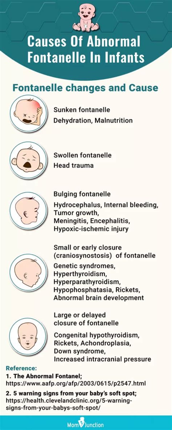 Discover The Secrets Of "Bella Fontanelle Mom" For Enhanced Baby Care