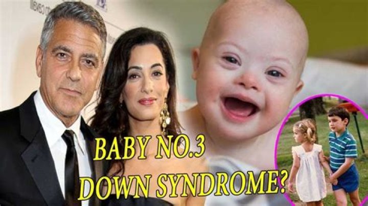 George Clooney's Child With Down Syndrome