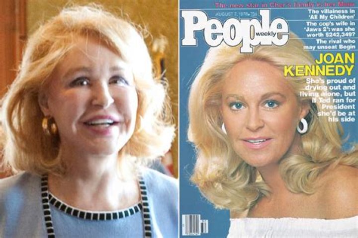 Joan Bennett Kennedy Biography, Life, Interesting Facts |