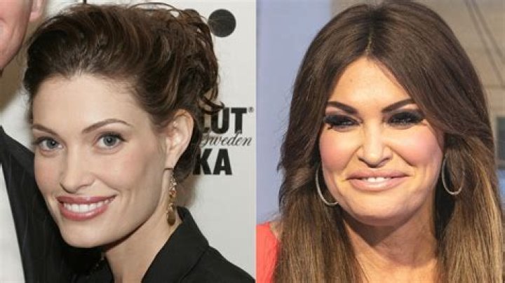 Kimberly Guilfoyle's Plastic Surgery Journey: Unveiling The Truths